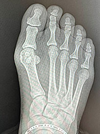 before surgery