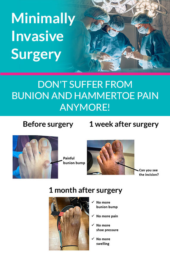 Minimally Invasive Surgery