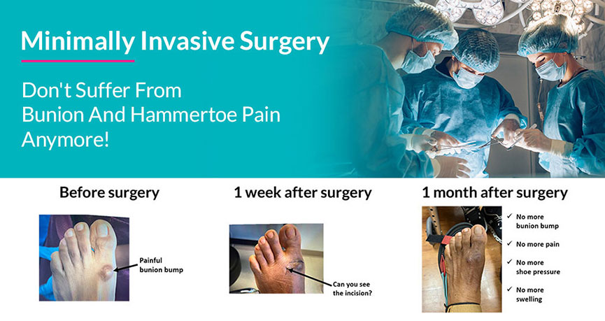 Minimally Invasive Surgery Treatment in the Miami-Dade County, FL: Miami (Hialeah, Opa-locka, Coral Gables, Aventura, Ojus, Westview, Golden Glades, Biscayne Park, Brownsville, Gladeview, Surfside, Bal Harbour, Hialeah Gardens, Medley, Miami Springs, Miami Lakes) areas