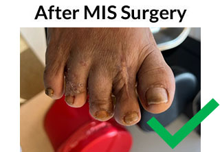 Minimally invasive surgery treatment in the Miami-Dade County, FL: Miami (Hialeah, Opa-locka, Coral Gables, Aventura, Ojus, Westview, Golden Glades, Biscayne Park, Brownsville, Gladeview, Surfside, Bal Harbour, Hialeah Gardens, Medley, Miami Springs, Miami Lakes) areas