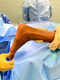 foot surgery