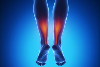 Achilles tendonitis treatment in the Miami-Dade County, FL: Miami (Hialeah, Opa-locka, Coral Gables, Aventura, Ojus, Westview, Golden Glades, Biscayne Park, Brownsville, Gladeview, Surfside, Bal Harbour, Hialeah Gardens, Medley, Miami Springs, Miami Lakes) areas