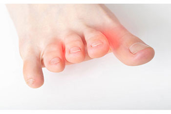 Mortons neuroma treatment in the Miami-Dade County, FL: Miami (Hialeah, Opa-locka, Coral Gables, Aventura, Ojus, Westview, Golden Glades, Biscayne Park, Brownsville, Gladeview, Surfside, Bal Harbour, Hialeah Gardens, Medley, Miami Springs, Miami Lakes) areas