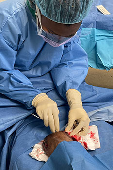 Wound & Ulcers Treatment Wound care treatment in the Miami-Dade County, FL: Miami (Hialeah, Opa-locka, Coral Gables, Aventura, Ojus, Westview, Golden Glades, Biscayne Park, Brownsville, Gladeview, Surfside, Bal Harbour, Hialeah Gardens, Medley, Miami Springs, Miami Lakes) areas