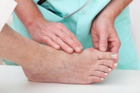 Surgical and Nonsurgical Treatments for Bunions